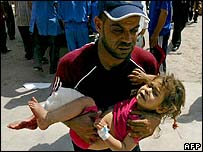 Criança ferida é levada a hospital em Kirkuk