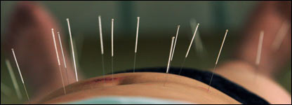 针灸