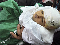 قربانی حملات اسراییل