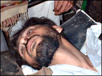 زخمی حضرت جمال