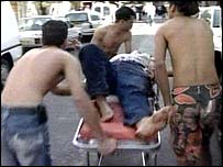 इसराइल हमला