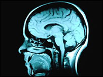 मस्तिष्क