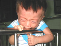 Một cháu bị nhiễm HIV ở Việt Nam