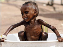 Açlık çeken bir çocuk