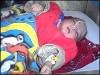 عدم کفايه در اطفال