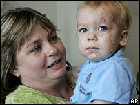 Bombeiros pensaram que Kysson Stowell era um boneco quando o encontraram