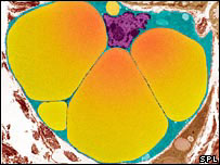 Armazenamento de gordura na célula