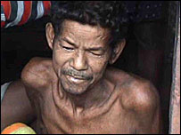 भूख से प्रभावित एक व्यक्ति 