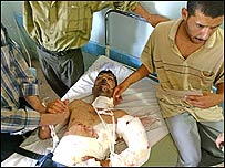 बाक़ूबा हमले में घायल