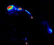 gravitational lens [pic: Jodrell Bank]