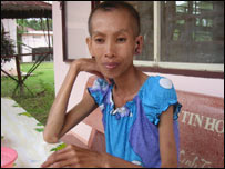 ایڈز کا مرض جان لیوا ثابت ہو سکتا ہے