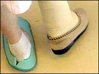 Perda óssea aumenta risco de fraturas