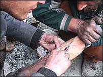 وزارت بهداشت افغانستان می گويد که افزايش معتادان تزريقی مواد مخدر که از سرنگ مشترک استفاده می کنند، يکی از دلايل گسترش ايدز در اين کشور است