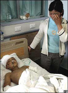 Em Trương Gia Trì bị mất cả hai cánh tay khi trường học bị sập. Cậu hiện đang được điều trị tại bệnh viện Đức Dương bên cạnh mẹ.