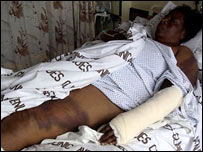 Ông Sekai Holland, nhân viên của phe đối lập MDC đang ở trong nhà thương