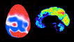 brain scans