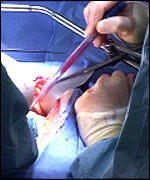 surgeons operating on Lynn Greeberg's stomach