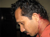 JVP MP after the attack
