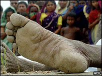 हादसे का शिकार एक व्यक्ति