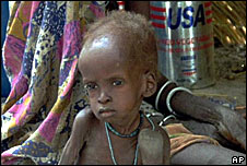 A malnourished child in Sudan