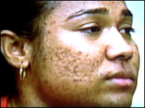 प्रतिमा कुमारी