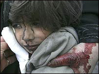 Thường dân bị thương 