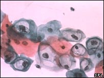 人类乳头瘤病毒