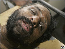 Poddala Jayantha in hospital on 01/06/09