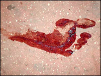 धमाके के बाद