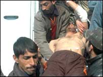 زخمی کشمیری شہری