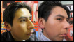 Juan Carlos before and after surgery