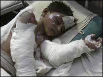 अहमदाबाद के अस्पताल में यश 