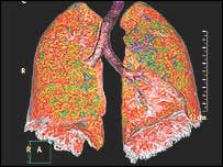 Imagem feita com novo equipamento da Philips