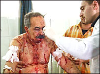 एक घायल व्यक्ति अस्पताल में