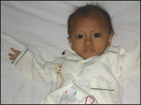 Một cháu bé nhiễm HIV ở Việt Nam