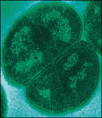 "Deinococcus radiodurans" Foto: Departmento de Energia dos Estados Unidos