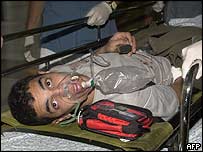 فسلطینی زخمی