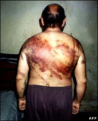 قیدیوں پر تشدد کے الزامات لگائے گئے ہیں