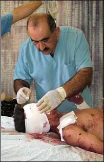 مجروح لبنانی