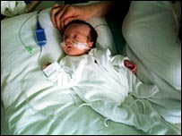 Bebê prematuro