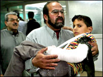 हमले में घायल बच्चा